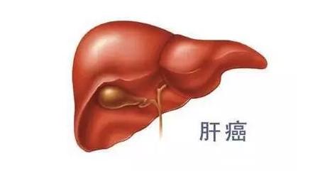 乙肝病人怎樣預防肝癌？