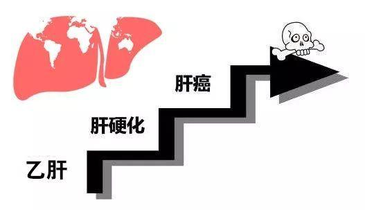 給乙肝患者的7個運動建議?